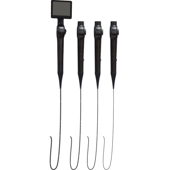 Electronic bronchoscopy