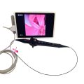 Electronic bronchoscopy