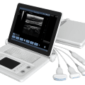 Youkey F6 Portable Ultrasound